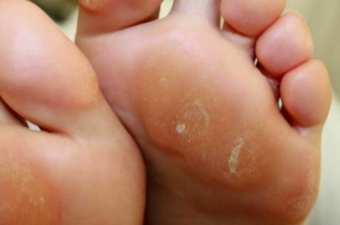 clinica de podologia en sevilla