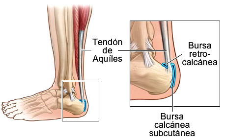 dolor de pies sevilla