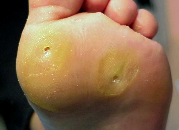 julia franco podologa