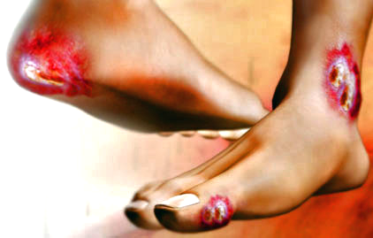 podologia en sevilla