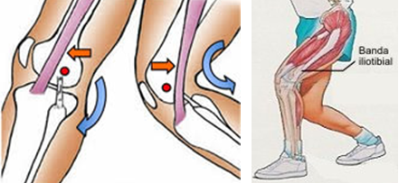 podologo para deportistas sevilla